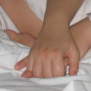181