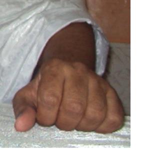 305